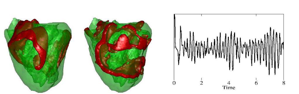 Page 12 of 34 Figure 6: Wavefronts (in red on the left) and ECG signals (right). Top: dataset 1. Bottom: dataset 2.