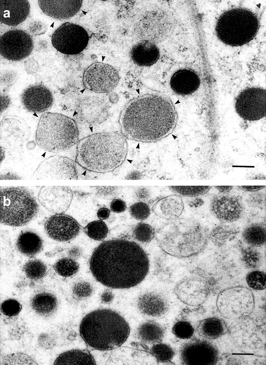 416 A.W. Henkel et al./febs Letters 505 (2001) 414^418 Fig. 3. Endocytosis of LDCV membrane by large vesicles.