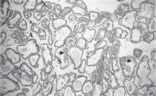 Fig.--4: A low power (X10 objective) photomicrograph showing prostatic tissue in vehicle control rat; acini (A), stroma (S), epithelium (arrow). H&E stain. Fig.