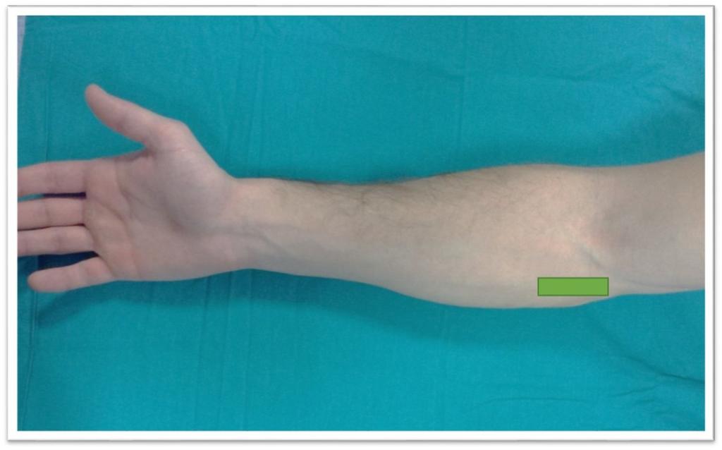 Fig. 12: Medial elbow