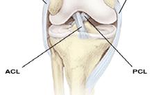 Knee Anatomy Biomechanics Joint Reactive Force Tibiofemoral 3x body weight walking 4x climbing Patellofemoral: 7 x squatting 2-3 x descending stairs Screw-Home Mechanism As knee Extends, the Tibia