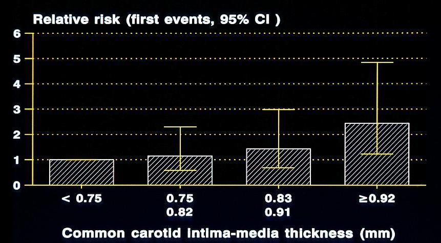 Carotid Disease as a Marker of Cardiovascular
