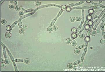 Candidiasis Candida albicans is the most important species of candida (other species ).