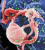 6/1/2011 HIV Devastates the Immune System HIV Devastates the Immune System Research Feature Every day, HIV destroys billions of CD4+ T cells in a person infected with HIV, eventually overwhelming the