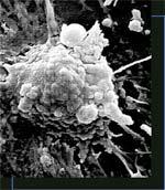 Killing Cells Directly CD4+ T cells infected with HIV may be killed when a large amount of virus is produced and buds out from the cell surface.
