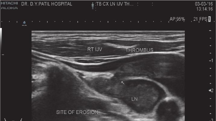 Figure 2: Cervical