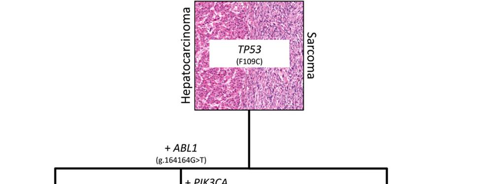 Liver carcinosarcoma TP53 (F109C) Carcinosarcoma is monoclonal Report of clonal heterogeneity Targets for therapy TP53 (F109C) TP53 (F109C) TP53 (F109C)