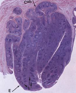 lymphoid organ (150g) immune filter of the blood erythrocytes destruction Ab production The development of the spleen from 5 th week derived from mesenchym in dorsal mesogastrium mesenchymal