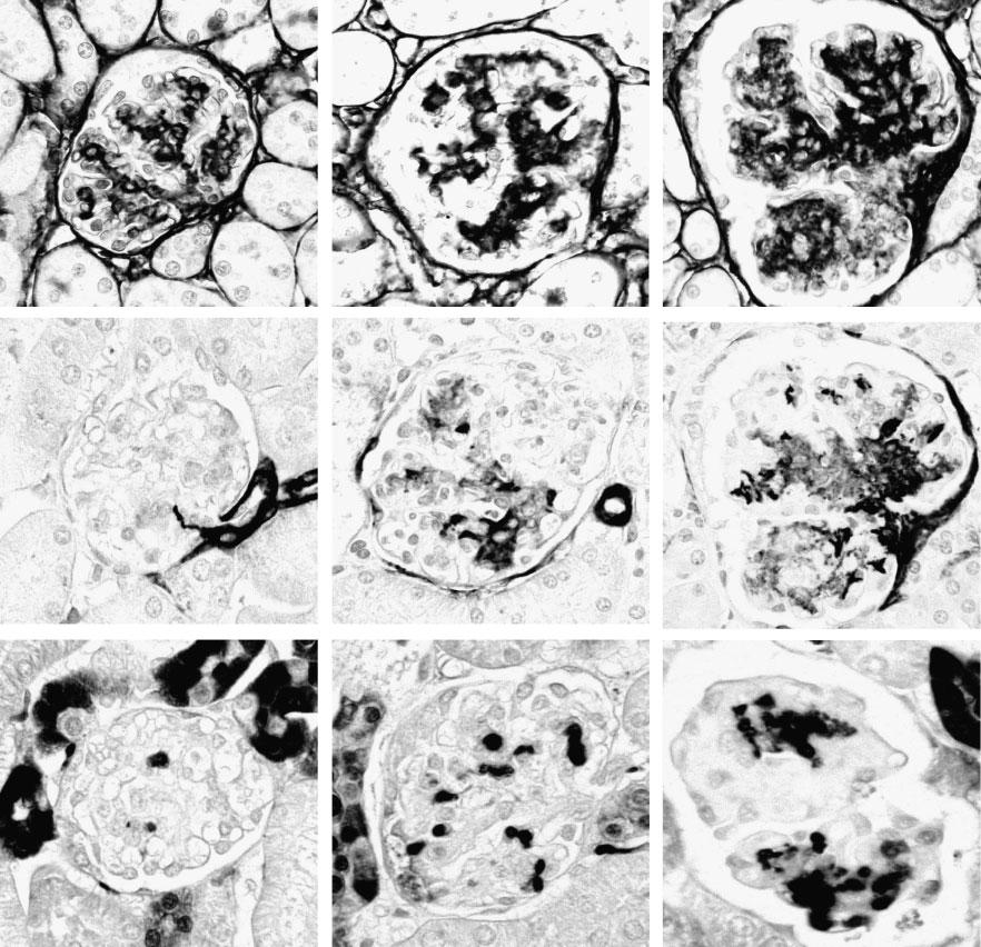 3456 M. Iyoda et al. Collagen IV A B C αsma D E F Mac-2 G H I WT-Vehicle TSLP-Vehicle TSLP-ATRA Fig. 3. ATRA exacerbates multiple features of glomerulonephritis in TSLP transgenic mice.