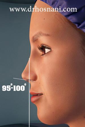Profil view Nasolabial angle should be 90 -+ 10 degree It guid the upper lip support by the