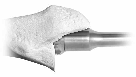 Cone Reaming Cone Reamer sizes are 20mm, 22mm, 24mm, 26mm, 28mm, 30mm, and 32mm*. This references the diameter at the proximal end of the cone reamer. Available Proximal Bodies are listed below.