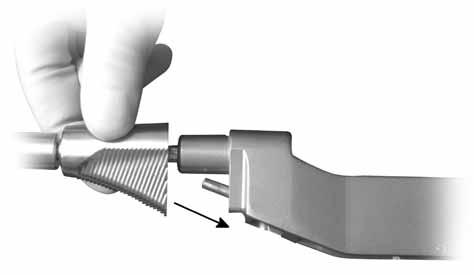 Distal Pilot Medial Broach Broach Handle Medial Preparation - Broaching Method Assembly The same diameter Distal Pilot used for