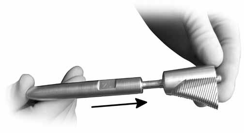 Figure 18 Figure 19 The Distal Pilot and Medial Broach are then attached to the Broach Handle.