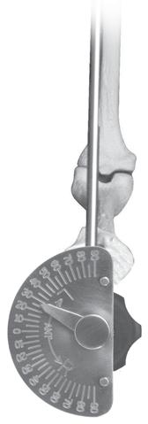 Figure 72 Figure 73 If the Neck Positioner does not return to the locked position, slightly turn the Version Adjustment Tool and the