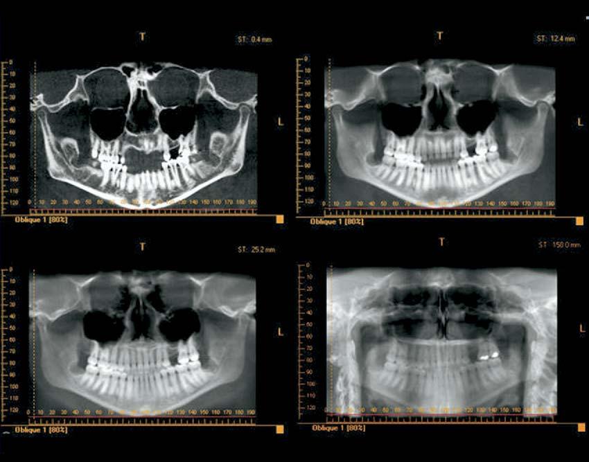 262 Farman and Scarfe American Journal of Orthodontics and Dentofacial Orthopedics August 2006 Fig 7.
