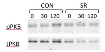 A ppkb tpkb B Figure 5. PKB phosphorylation during OGTT following two nights of control sleep (CON) or sleep restriction (SR) (n=9).