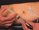 STEP 5: Inserting your injection needle Pinch an area of skin as shown in the picture below.