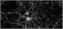 100 billion neurons Each neuron has 10,000