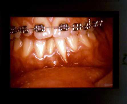 Connection between orthodontic and other anomalies Malocclusion Malocclusion
