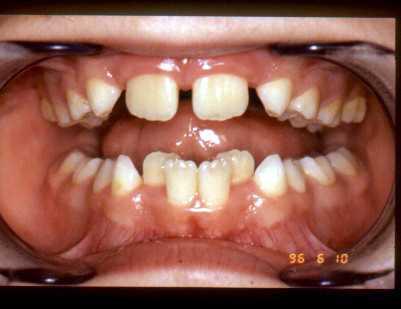 Subject of orthodontics diagnosis, treatment, prevention of the