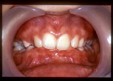 Subject of orthodontics
