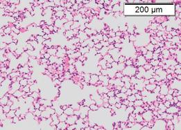 high-dose coinfection at 7 dpi (n = ). D H&E staining of lung tissue sections at dpi during high-dose coinfection.