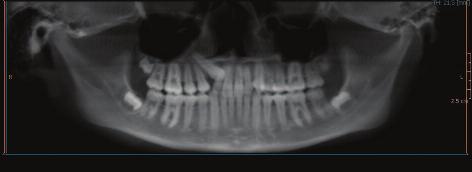 Clinical The ecstasy of CBCT: applications, image output and decision points for purchase Many recent articles on CBCT have reported quite a number of applications.