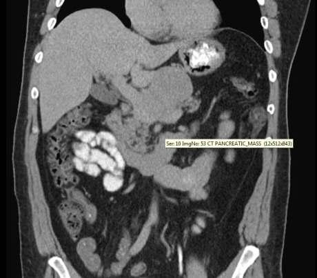 views on CT of abdomen/pelvis