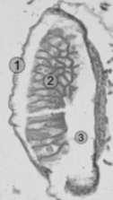 The epithelial component consists of simple columnar epithelium (prismatic) located on an evident basement membrane.