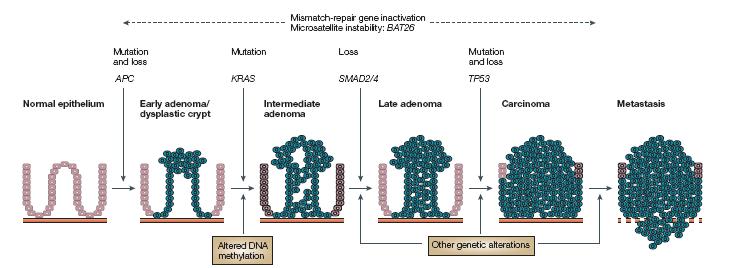 The colorectal adenomo-carcinoma sequence A well defined molecular/pathological sequence of colorectal cancer development has