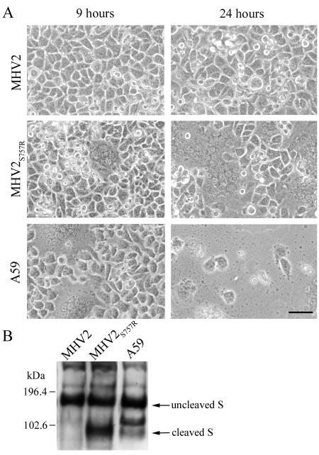 VOL. 80, 2006 ENDOSOMAL CATHEPSIN-DEPENDENT MURINE CORONAVIRUS ENTRY 5773 FIG. 6. (A) Effect of S757R substitution in MHV-2 spike on cellcell fusion.