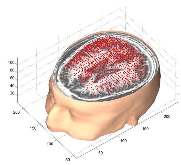 Cortical Model Created from Volumetric MRI Data 4,000 cortical locations 3
