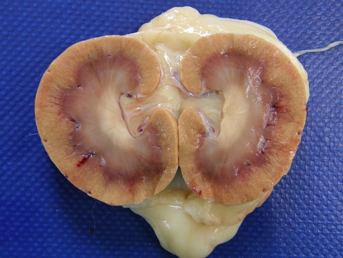 While applying this dorsal pressure use a sharp knife to cut through the kidney from cortex to renal pelvis and butterfly open the