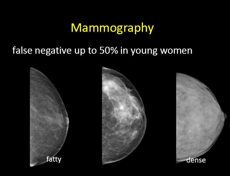 Mammographic Sensitivity 98% in women 50 with fatty breasts 30-69% sensitivity in women with dense breasts, particularly low if < 50 or