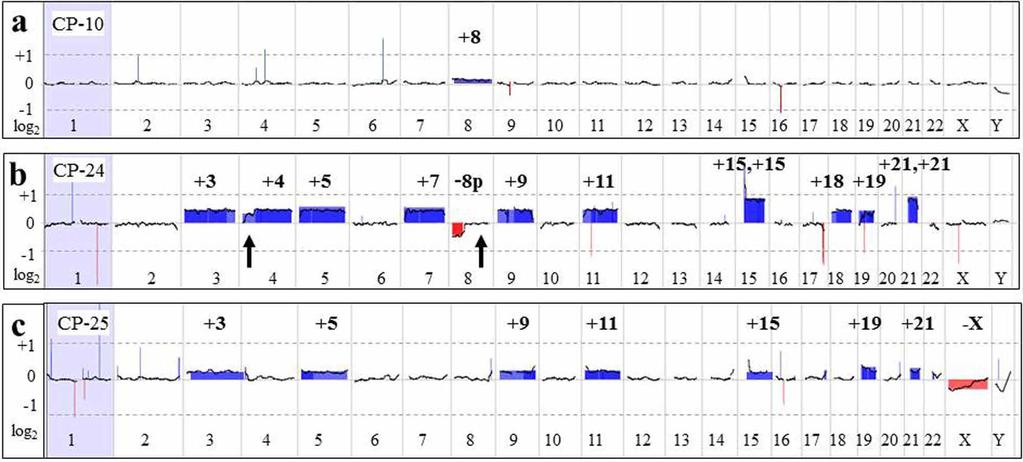 Figure 4: Large chromosomal aberrations detected by acgh analysis. a. Whole genome microarray plot from CP-10.