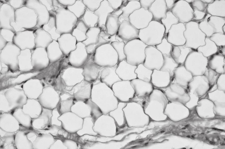 3 2 Adipose tissue, which is composed of cells known as adipocytes, stores large quantities of triglycerides and functions as an energy storage tissue. Fig. 2.1 is a photomicrograph of adipose tissue.