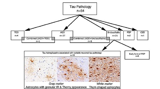 Age associated neuronal tauopathies Kovacs GG, Milenkovic I, Wöhrer A, et al.