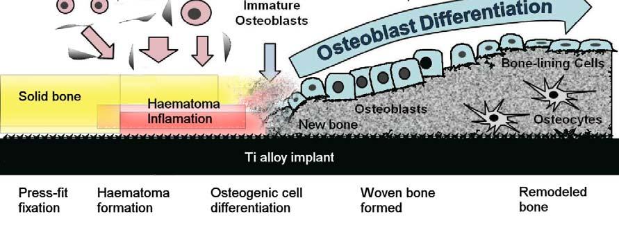 Osseointegration bone ingrowth Blood-borne cells and proteins form haematoma Migration of inflammatory cells to the surface Attraction of multipotent cells from bloodstream