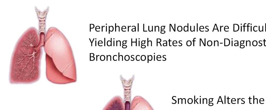 Proprietary Science: Innovative Field of Injury Genomic Technology Peripheral Lung Nodules Are Difficult to Biopsy,
