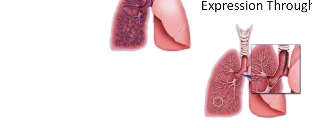 Airway A Gene Signature of a Cytology Sample Collected from the Airway Can Determine Cancer Risk in a Peripheral Lung