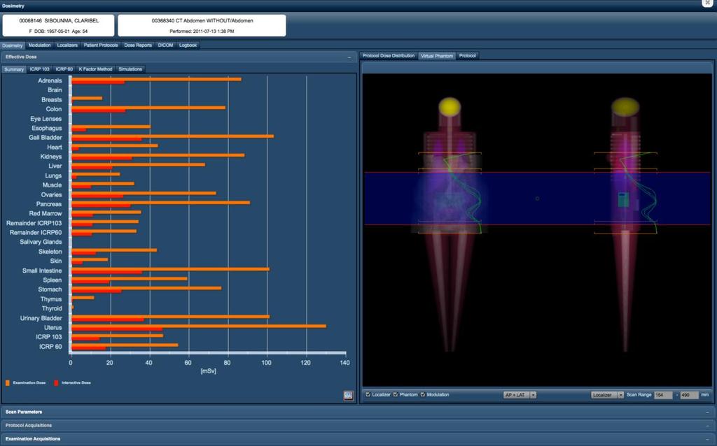 More recent developments: exposure TM (Radimetrics TM Inc) Commercial solution Advanced interface between dosimetry
