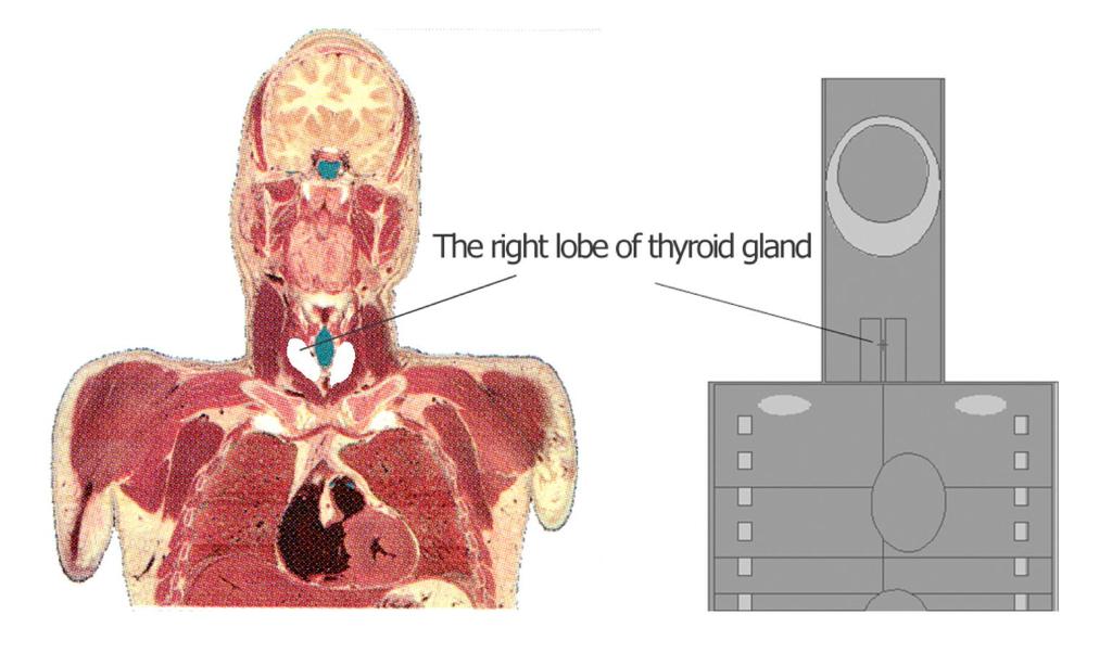 Unrealistic thyroid location Visible Human Project Anatomy