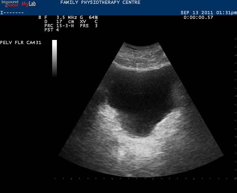 Real Time Ultrasound - Example Exercise # 1: