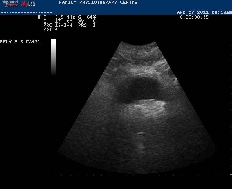 Real Time Ultrasound - Example Exercise # 2:
