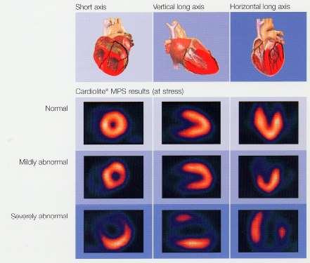 In a typical nuclear cardiac imaging exam, the physician reviews: Static Summed Perfusion Images Dynamic Gated