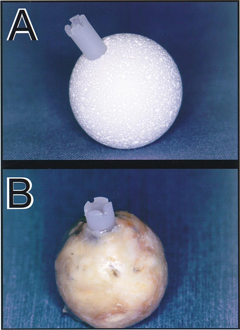 S. KAWAI ET AL. 69 MOBILITY OF HYDROXYAPATITE ORBITAL IMPLANT Figure 1. Surgical procedure for placing the autologous sclera-covered implant.