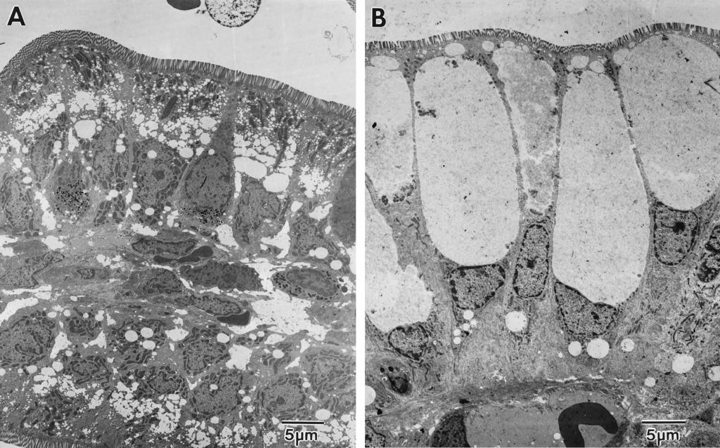 50 CIARLET ET AL. J. VIROL. FIG. 6. Electron micrographs of ultrastructural appearance of the ileum of PBS-inoculated (A) or RRV-inoculated (B) 5-day-old rats at 48 hpi.