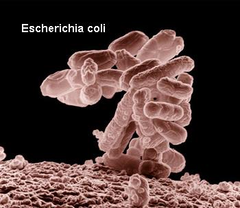 Responsible Pathogens Escherichiacoli ( most common) Pseudomonas