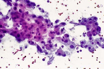 Cytologic features of various types of breast