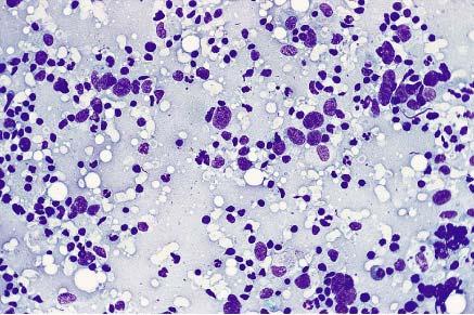 Cytologic features of various types of breast